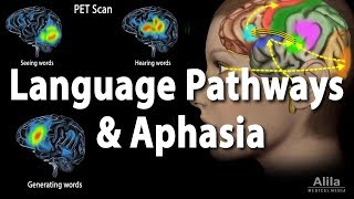 Language Pathways and Aphasia Animation [upl. by Crysta504]