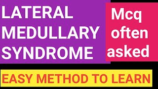 Lateral Medullary syndrome  MCQ amp mneumonic [upl. by Marcello]