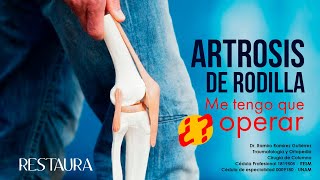 Artrosis de Rodilla ¿Me tengo que operar [upl. by Olra]