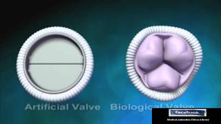 Biological Aortic Heart Valve  Animation Video [upl. by Ranchod585]