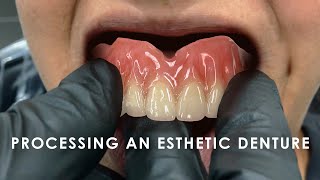 How to Process an Esthetic Denture [upl. by Luckett]