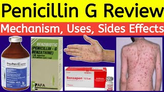 Penicillin g Benzathine injection Review  Benzapen injection  Uses How it work Side Effects [upl. by Pappas]