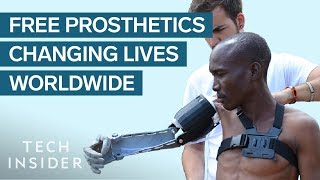 Meet The 24YearOld Whose Prosthetic Limbs Are Changing Lives [upl. by Gant604]