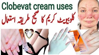 clobevate cream for hands and feet whitening  clobevate for skin whiteing  clobetasol  eczema [upl. by Rahal]