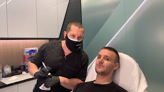 FILLER TO JAWLINE AND CHIN FOR MASCULINE LOOK  Dr Jason Emer  West Hollywood CA [upl. by Nahallac]