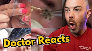 Dermatologists Reaction to Viral Pimple Popping Cyst Popping TikToks [upl. by Tyree]