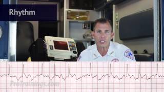 Atrial Fibrillation ECG Rhythm Interpretation [upl. by Fogel]