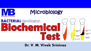 BIOCHEMICAL TEST  Bacterial Identification Technique  Microbiology  Vivek Srinivas Bacteriology [upl. by Nyrahs]