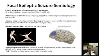 Diagnosis of Epileptic Syndromes [upl. by Siurtemed]