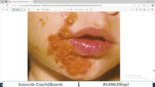 Chp41 Pharma Lippencott  Drugs used to treat Superficial Skin Infections [upl. by Shelton87]