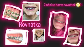 Rovnátka 😬 ✨ [upl. by Glarum]