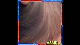 ASMR LICE REMOVE lice hair hairstyle liceremoval haircare [upl. by Odnumyer]