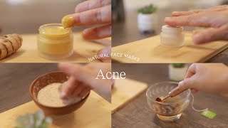 Clear and glow your skin naturally 5 Best DIY AcneFighting Face Mask [upl. by Gerrit]