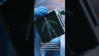 Nanotechnology in Medicine Miracle Cure or Hidden Danger medicalbreakthroughs medicaltechnology [upl. by Acirretahs774]