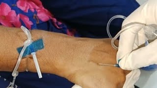 venipuncture using a butterfly needle [upl. by Bortz]