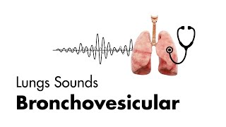 Bronchovesicular Breath Sounds  Lung Sounds  MEDZCOOL [upl. by Celin824]