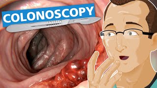 Colonoscopy [upl. by Suinuj702]