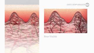 MICRODERMABRASION  IONTOCOMED® [upl. by Aneeled242]