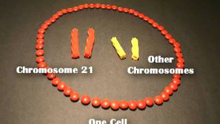 Nondisjunction Trisomy 21  An Animated Tutorial [upl. by Clover256]