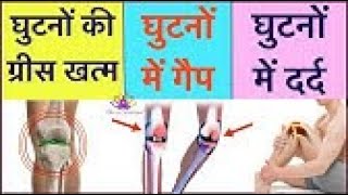 Diacerein Glucosamine Sulphate MSM Tablet review in hindi [upl. by Honeyman]