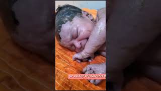 Newborn Received With Meconium Stained youtube youtubevideo viralvideobabydocter pediatrician [upl. by Naloc]