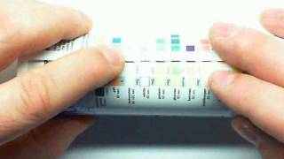 Urinalysis Part 1mp4 [upl. by Dutch]