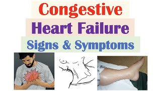 Congestive Heart Failure Signs amp Symptoms amp Why They Occur [upl. by Notxam]