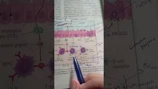 Pathogenesis of Celiac Disease  Robbin  Pathology [upl. by Lawan]