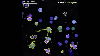 LIVE Cytotoxicity Assay subpopulation segmentation [upl. by Laon]