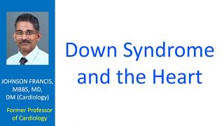 Down Syndrome and the Heart [upl. by Gadmann]