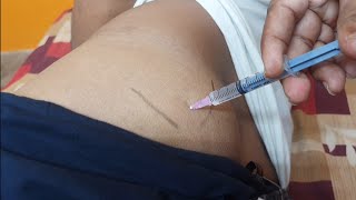 IM इंजेक्शन देने का सही तरीका  Easy steps to give Intramuscular injection  IM injection technique [upl. by Yarehs]