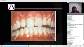 Periodontics  Gingiva and Tooth Supporting Structure [upl. by Nova]