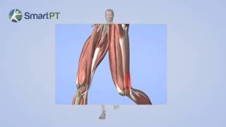 Tensor Fascia Latae Syndrome [upl. by Elburt414]