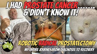 PROSTATE CANCER  My full journey from Diagnosis to Recovery  Ep 69 [upl. by Othella]