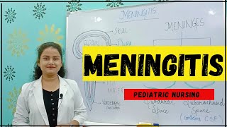 MENINGITIS  MENINGITIS CHILD HEALTH NURSING CAUSES SIGN AND SYMPTOMS MANAGEMENT OF MENINGITIS [upl. by Wimsatt]