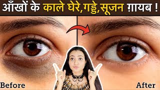 In 7 Days 💕 Remove DARK CIRCLES काले घेरे PUFFY EYES गड्ढे SUNKEN EYES Naturally  100 Results [upl. by Tillie812]