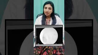 Why Hysteroscopy is done in IVF treatment drrakshitamalik drshalinilohan ivftreatmentforpregnancy [upl. by Eterg764]