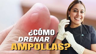 Drenando ampollas después del ejercicio SIN DOLOR [upl. by Fariss]