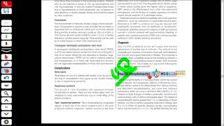 Hepatic encephalopathy from Davidson  Medicine  UrduHindi  Medical Globe Elearning [upl. by Anaitat452]