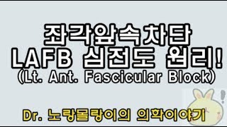 Left anterior fascicular blockhemiblock좌각앞속차단 좌각전지블록 심전도ECG 원리 [upl. by Sigrid]