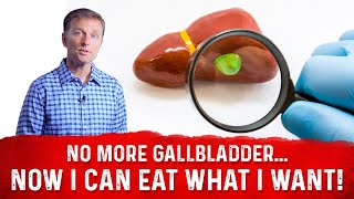 Gallbladder Removed Can I Eat What I Want – Dr Berg [upl. by Shayn]