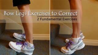 Exercises To Correct Bowed Legs  How to Fix Bowed Legs [upl. by Katti842]