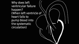 Cause of left ventricular failure [upl. by Orten]