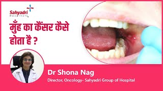 मुँह का कैंसर कैसे होता है  Mouth cancer symptoms in Hindi  Dr Shona Nag Sahyadri Hospital Pune [upl. by Ayotel]