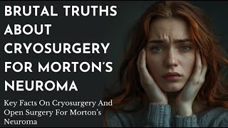 Here are some direct straightforward facts about cryosurgery for Mortons Neuroma [upl. by Crispas]