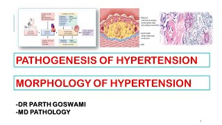 Hypertension  Pathogenesis  Morphology  Arteriosclerosis [upl. by Cailean]