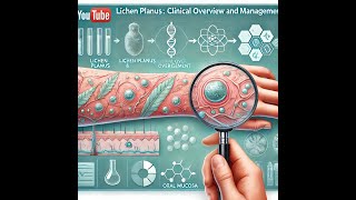 Lichen Planus Clinical Overview and Management [upl. by Holtorf627]