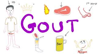 Gout [upl. by Bernadine]