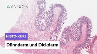 Histologie Dünndarm und Dickdarm  Mikroskopische Anatomie  AMBOSS Video [upl. by Parlin]