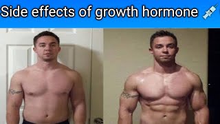 My subscriber took growth hormoneSide effects of growth hormone peptide [upl. by Hashim]